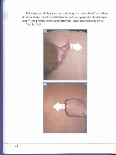 Náhled Dornova metoda i ty můžeš