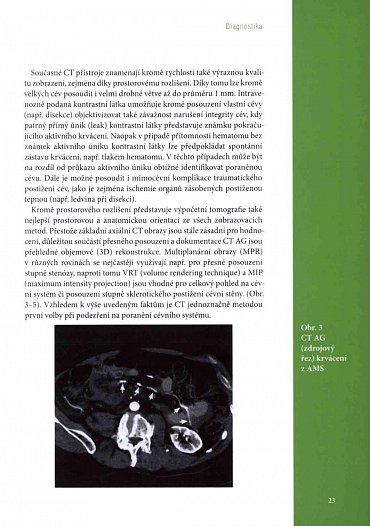 Náhled Poranění cévního systému