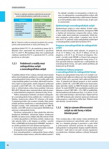 Náhled Spondyloartritidy