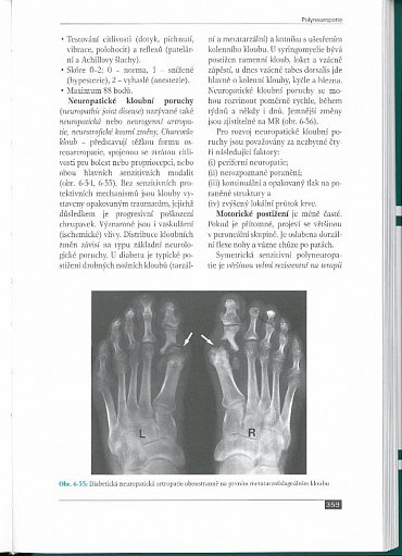 Náhled Poruchy periferních nervů