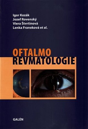 Oftalmorevmatologie