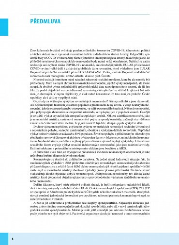 Náhled Spondyloartritidy