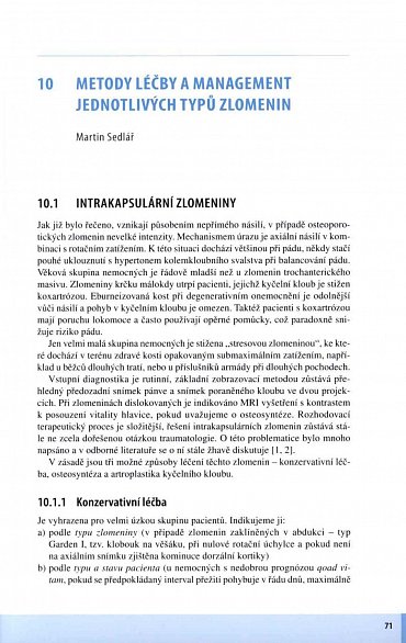 Náhled Zlomeniny proximálního femuru - Komplexní péče o pacienta