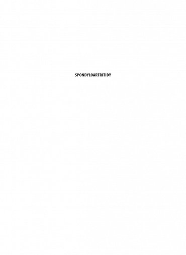 Náhled Spondyloartritidy