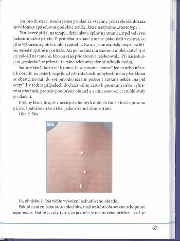 Náhled Dornova metoda i ty můžeš