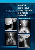 Funkční rentgenová analýza páteře s klinickou aplikací