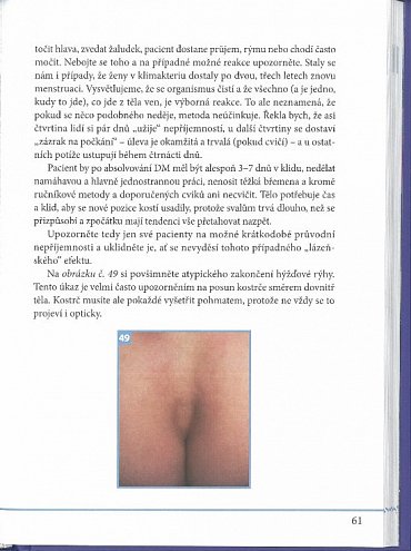 Náhled Dornova metoda i ty můžeš