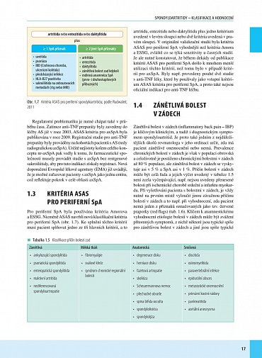 Náhled Spondyloartritidy