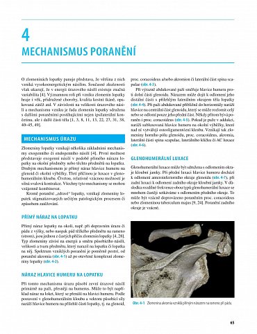 Náhled Zlomeniny lopatky