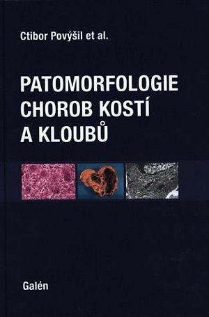 Patomorfologie chorob kostí a kloubů