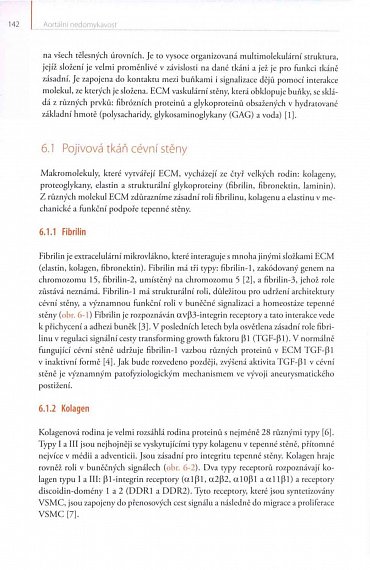 Náhled Aortální nedomykavost