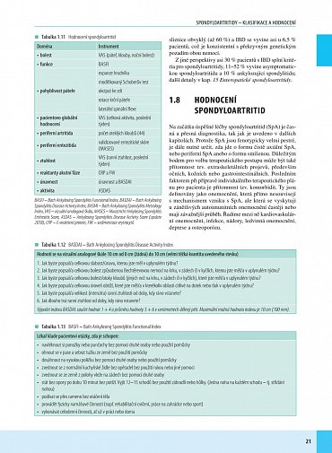 Náhled Spondyloartritidy