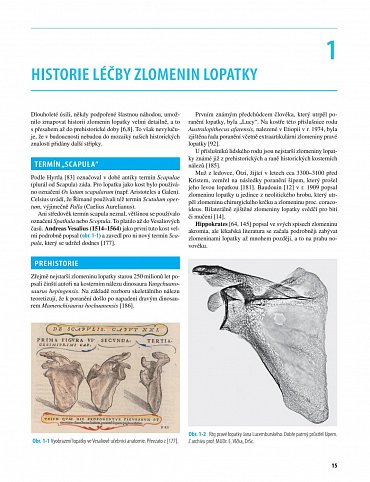 Náhled Zlomeniny lopatky