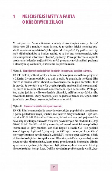 Náhled Žíly, žilky a varixy