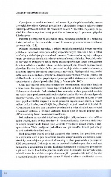 Náhled Zlomeniny proximálního femuru - Komplexní péče o pacienta