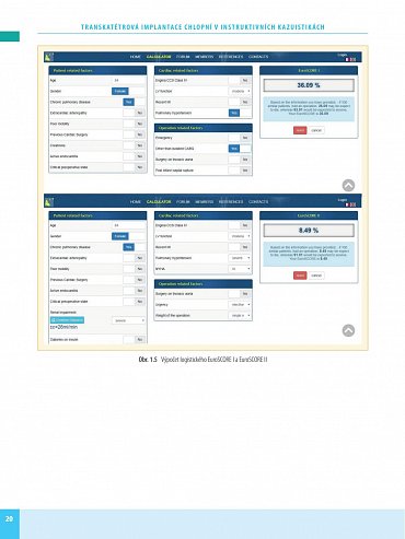 Náhled Transkatétrová implantace chlopní v instruktivních kazuistikách