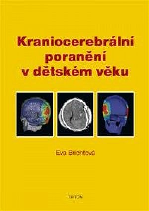 Kraniocerebrální poranění v dětském věku