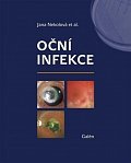Oční infekce