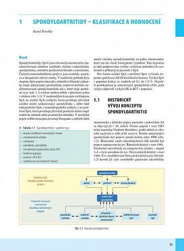Náhled Spondyloartritidy