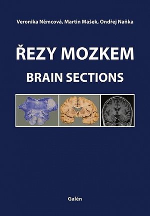 Řezy mozkem / Brain Sections