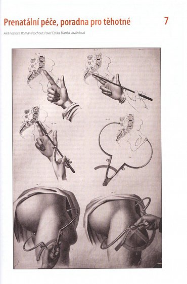 Náhled Moderní porodnictví