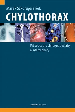 Chylothorax - Průvodce pro chirurgy, pediatry a interní obory