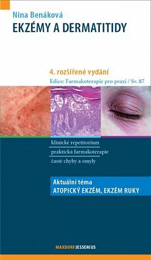Ekzémy a dermatitidy