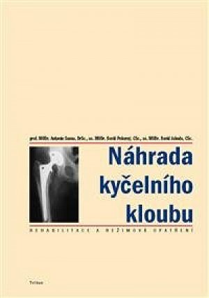 Náhrada kyčelního kloubu