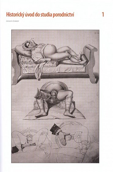 Náhled Moderní porodnictví