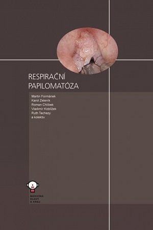 Respirační papilomatóza