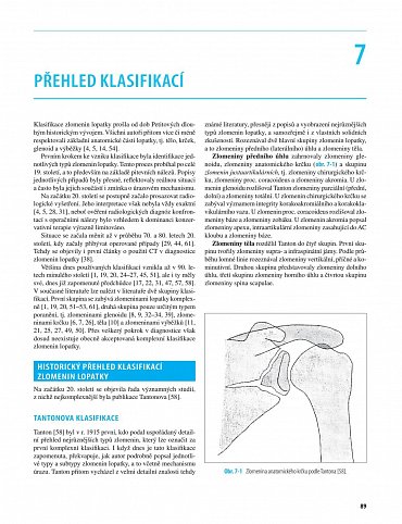 Náhled Zlomeniny lopatky