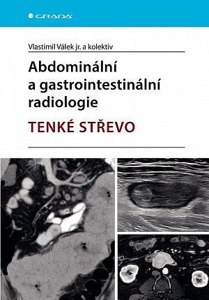 Abdominální a gastrointestinální radiologie - Tenké střevo