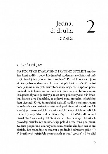Náhled Císařský řez - Co je dobré vědět o císařském řezu a jak souvisí porod se schopností milovat