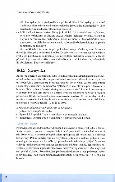 Náhled Zlomeniny proximálního femuru - Komplexní péče o pacienta
