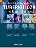 Tuberkulóza ve faktech i obrazech