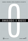 Onkologie v kostce