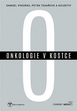 Onkologie v kostce