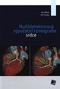 Multidetektorová výpočetní tomografie srdce