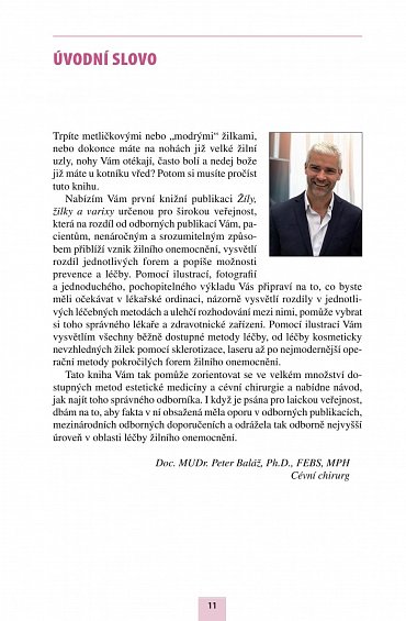 Náhled Žíly, žilky a varixy