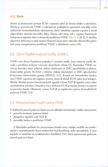 Náhled Aortální nedomykavost