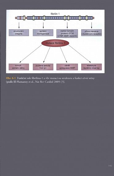 Náhled Aortální nedomykavost