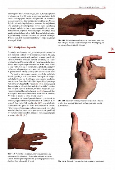 Náhled Chirurgie hlavových a periferních nervů s atlasem přístupů