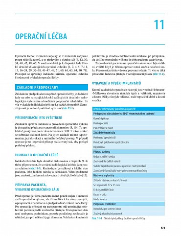 Náhled Zlomeniny lopatky