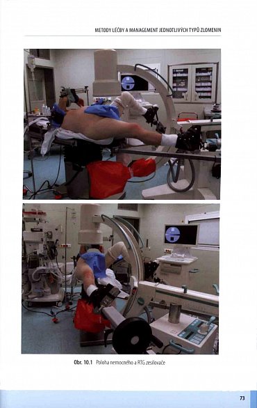 Náhled Zlomeniny proximálního femuru - Komplexní péče o pacienta