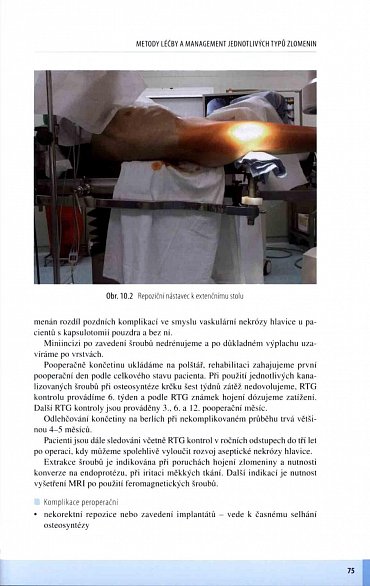 Náhled Zlomeniny proximálního femuru - Komplexní péče o pacienta