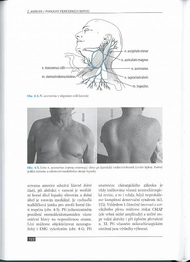 Náhled Poruchy periferních nervů