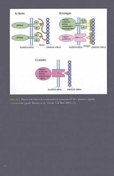Náhled Aortální nedomykavost