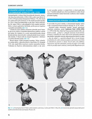 Náhled Zlomeniny lopatky