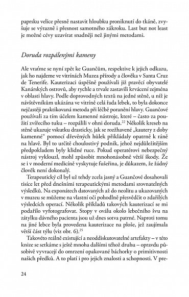 Náhled Medicína doby kamenné