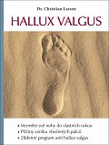 Hallux valgus
